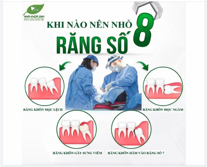 RĂNG SỐ 8 – NHỔ HAY KHÔNG?