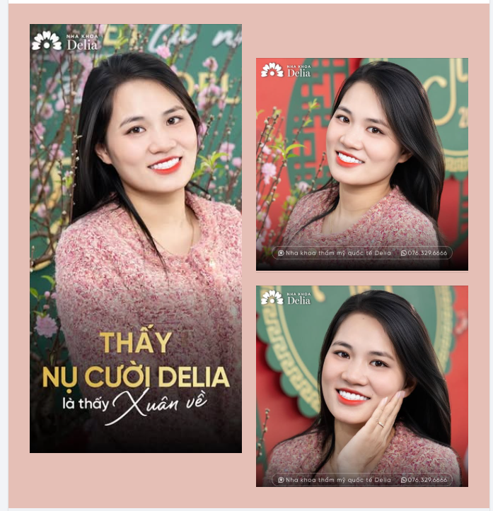 "Chỉ cần nhìn nụ cười rạng rỡ này thôi… là thấy Tết đã đến gần rồi