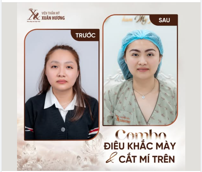 COMBO ĐIÊU KHẮC MÀY CẮT MÍ TRÊN ĐẸP NGAY SAU LÀM