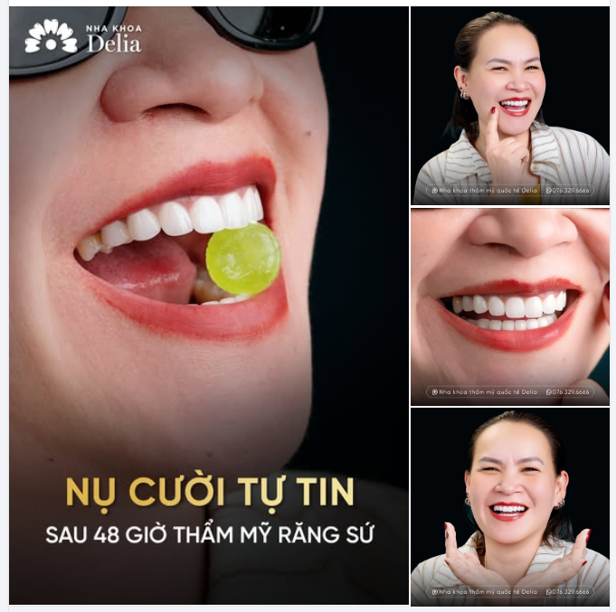 LÀM MỚI NỤ CƯỜI ĐÓN TẾT RẠNG NGỜI