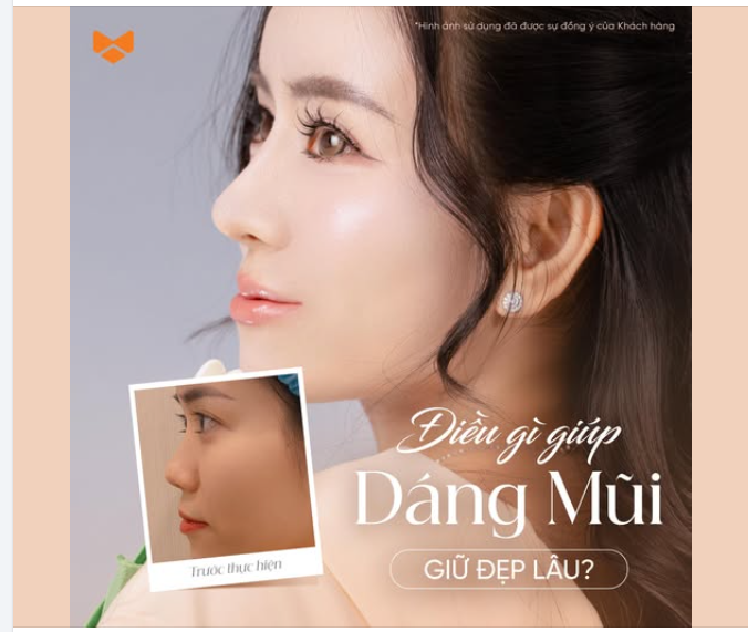 Điều gì giúp một dáng mũi giữ đẹp lâu?