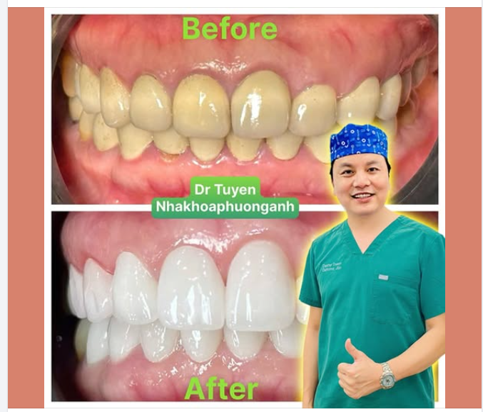Thay màu áo mới