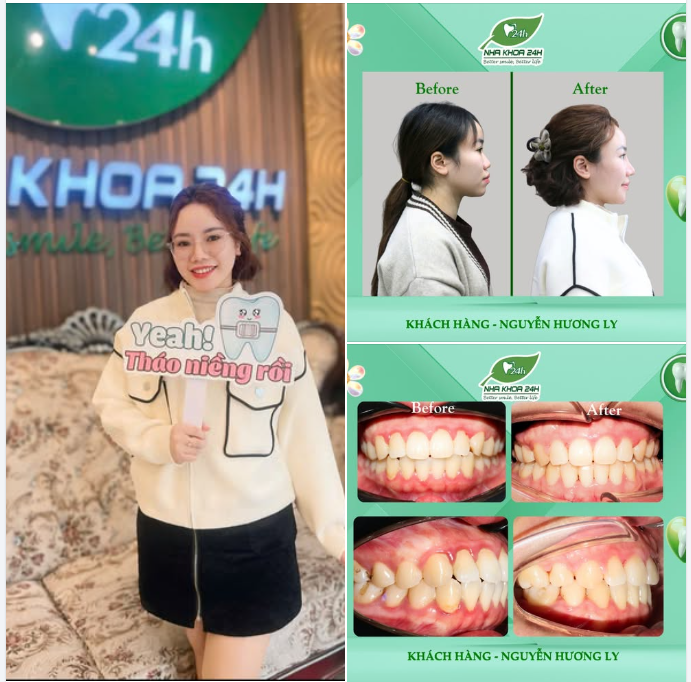 THÁO NIỀNG THÀNH CÔNG – CƯỜI XINH ĐÓN TẾT