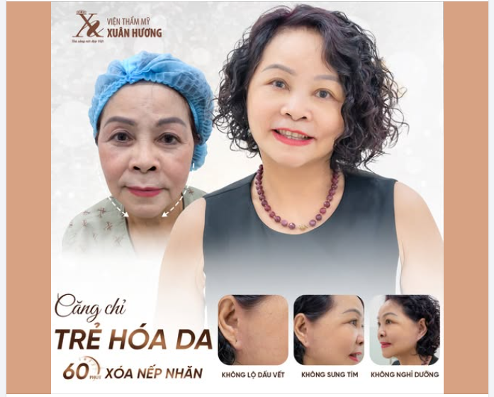 60 PHÚT XÓA NHĂN VỚI DỊCH VỤ CĂNG CHỈ TRẺ HÓA DA