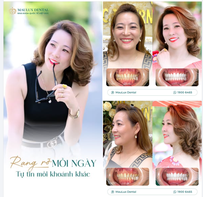 Phụ nữ đẹp nhất khi tự tin mỉm cười.