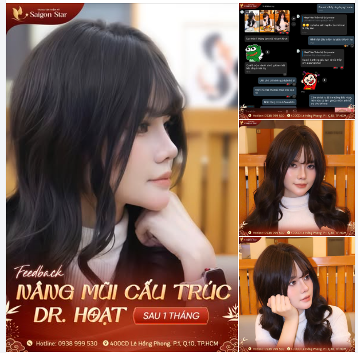 FEEDBACK KHOE SỨC MẠNH CỦA MŨI CAO - SAU 1 THÁNG NÂNG MŨI CẤU TRÚC DR. HOẠT