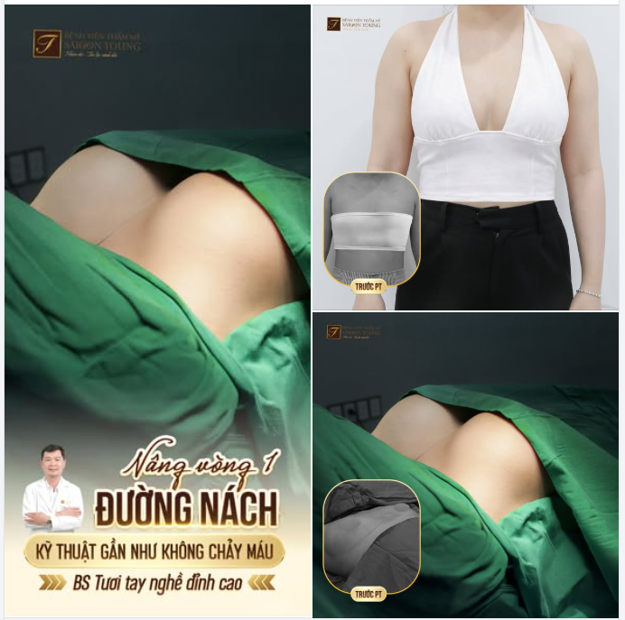 Giấu sẹo cực đỉnh - Đẹp khéo đến từng chi tiết