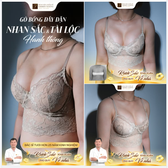 BÁC SĨ TƯƠI HƠN 25 NĂM KINH NGHIỆM KIẾN TẠO VÒNG 1 LÔI CUỐN