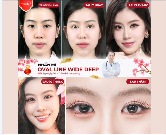 MẮT CHƯA ĐẸP – ĐỪNG VỘI ĐỔ LỖI CHO GEN!