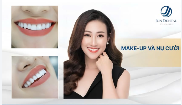 KHI NỤ CƯỜI ĐẸP LÊN, MAKE-UP CHỈ CÒN LÀ ĐIỂM NHẤN