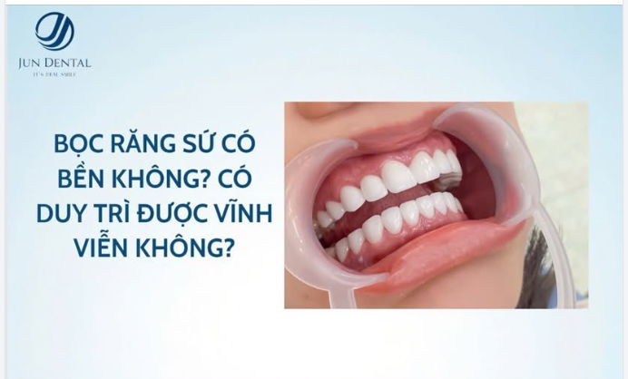ĐỘ BỀN CỦA RĂNG SỨ TOÀN SỨ: ĐIỀU BẠN CẦN BIẾT TRƯỚC KHI LÀM