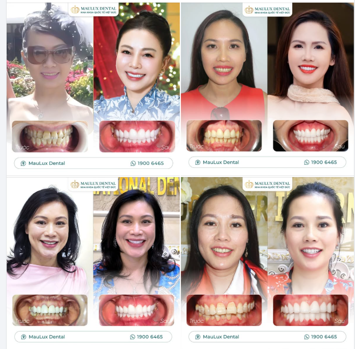 NỤ CƯỜI PHỤ NỮ – VẺ ĐẸP KHÔNG BAO GIỜ LỖI THỜI