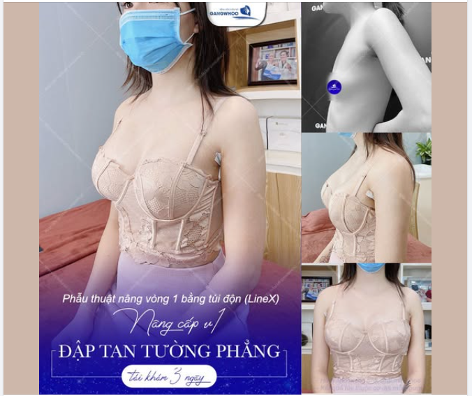 Sau 3 ngày tái khám, chị bước vào phòng tái khám với nụ cười rất tươi.