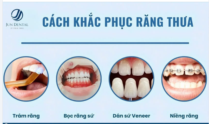 RĂNG THƯA – KHI KHOẢNG CÁCH NHỎ ẢNH HƯỞNG ĐẾN CẢ NỤ CƯỜI