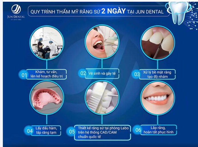 QUY TRÌNH TẠO NỤ CƯỜI CHUẨN JUN DENTAL – HOÀN THIỆN TRONG 2 NGÀY