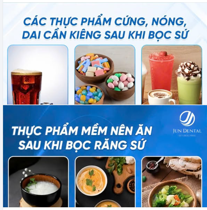 THỰC PHẨM NÊN VÀ KHÔNG NÊN DÙNG TRONG THỜI GIAN ĐẦU SAU KHI BỌC RĂNG SỨ