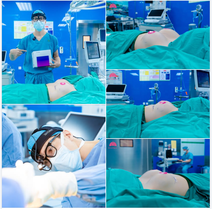 Vòng 1 sexy, căng tròn - Đón Tết tự tin cùng Mentor Boost