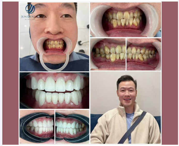 THAY ĐỔI NGOẠN MỤC – NỤ CƯỜI TỰ TIN HƠN MỖI NGÀY