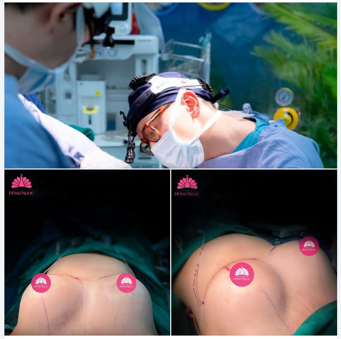 Tháo túi cũ, đặt túi mới kết hợp treo sa trễ cho KH "chubby" thích V1 quyến rũ, sexy