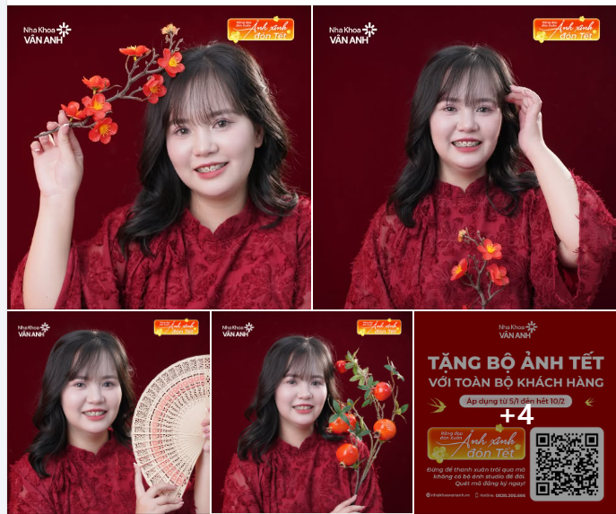 Ai bảo niềng răng là không thể xinh?