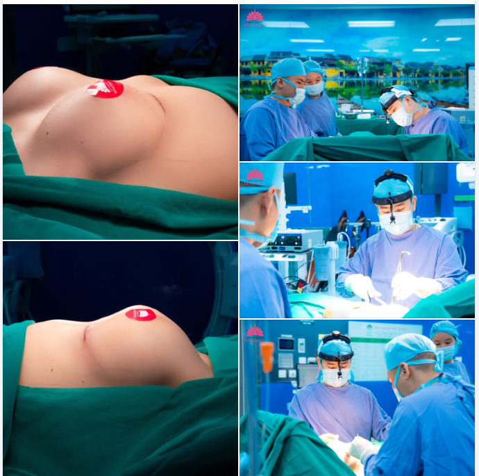 Váy ôm - trễ cổ vẫn nằm yên trong tủ vì vòng 1 chưa đủ tự tin