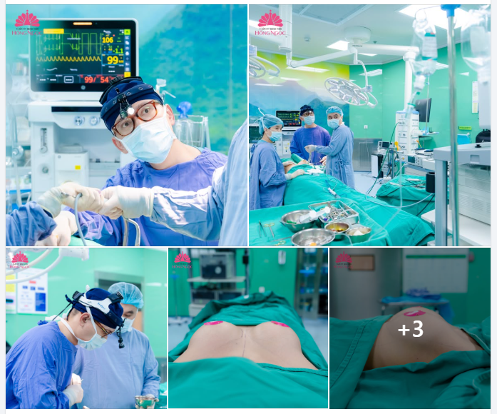 NÂNG NGỰC NỘI SOI - ĐẸP AN TOÀN, TINH TẾ, TỰ TIN TỎA SÁNG MÙA VALENTINE