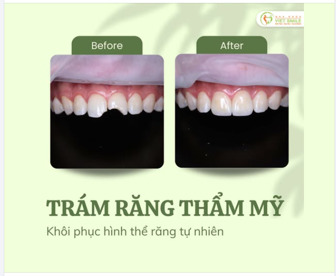 ĐỪNG ĐỂ MỘT VẾT MẺ NHỎ LÀM “KHUYẾT” ĐI SỰ TỰ TIN