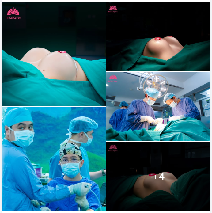 NGỰC XINH LÊN DÁNG - TỎA SÁNG MÙA YÊU