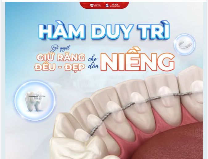 HÀM DUY TRÌ: "BÍ QUYẾT" GIỮ RĂNG ĐỀU ĐẸP BỀN VỮNG SAU NIỀNG