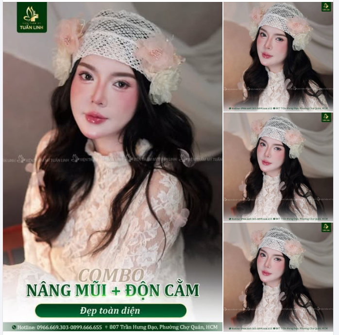NÂNG MŨI + ĐỘN CẰM COMBO ĐẸP TOÀN DIỆN!!