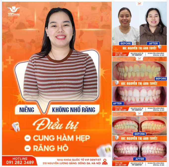NỤ CƯỜI TRỌN VẸN, ĐÓN TẾT AN NHIÊN
