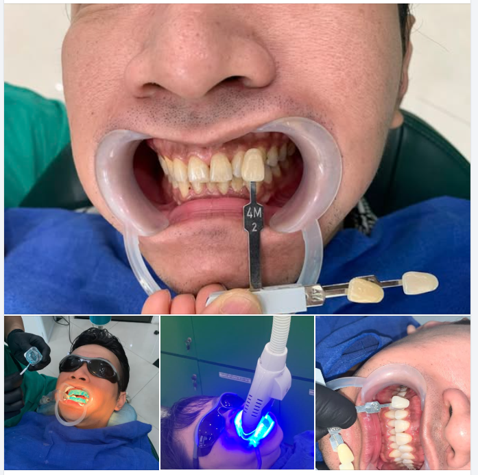 TẾT VUI VỚI NỤ CƯỜI TRẮNG SÁNG