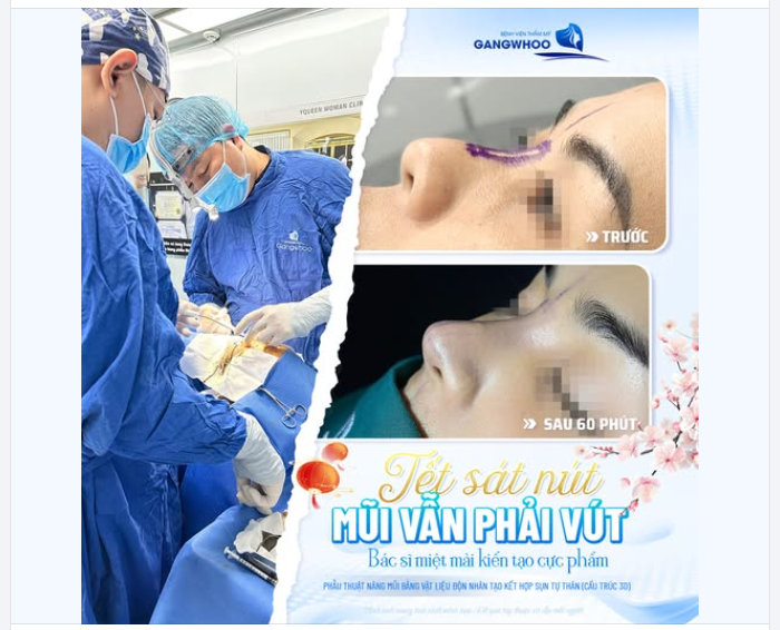 TẾT SÁT NÚT - MŨI VẪN PHẢI VÚT