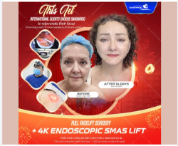 Không phải ngẫu nhiên mà các khách hàng từ Úc, Mỹ, Canada, Hàn Quốc... lại chọn Bệnh viện Thẩm mỹ Gangwhoo là điểm dừng chân cuối cùng trong hành trình tìm lại thanh xuân.