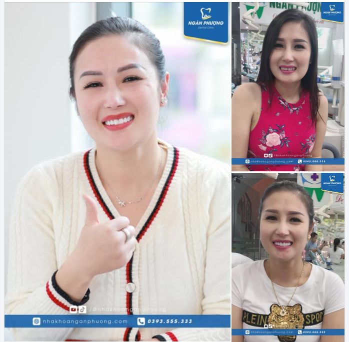 Răng sứ làm năm 2018 tại Ngân Phượng sẽ như thế nào?