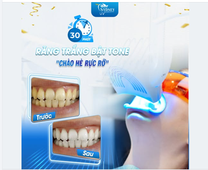 30 PHÚT RĂNG TRẮNG BẬT TONE - CHÀO HÈ RỰC RỠ