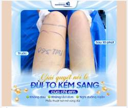 ĐÙI GỌN GÀNG – TỰ TIN HƠN MỖI NGÀY