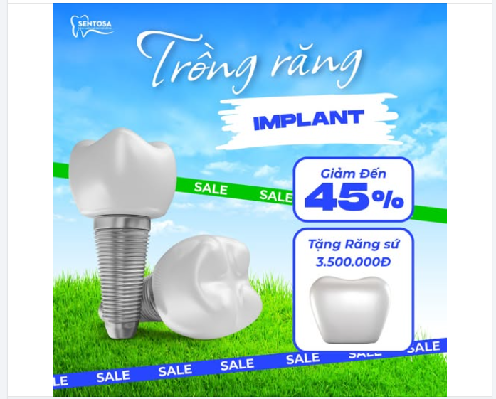 TRỒNG RĂNG IMPLANT – ƯU ĐÃI GIẢM ĐẾN 45% CHỈ CÓ TẠI SENTOSA