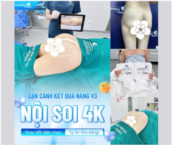 Tại BVTM Gangwhoo, dịch vụ Nâng V3 Nội soi 4K đang trở thành "cơn sốt" nhờ khả năng kiến tạo vòng 3 hoàn hảo, an toàn và cực kỳ tự nhiên.