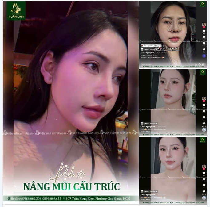 SANG CHẢNH - CUỐN HÚT - SẮC NÉT - ĐẸP CHUẨN TỈ LỆ  DÁNG MŨI KHIẾN KHÁCH MÊ NGAY!