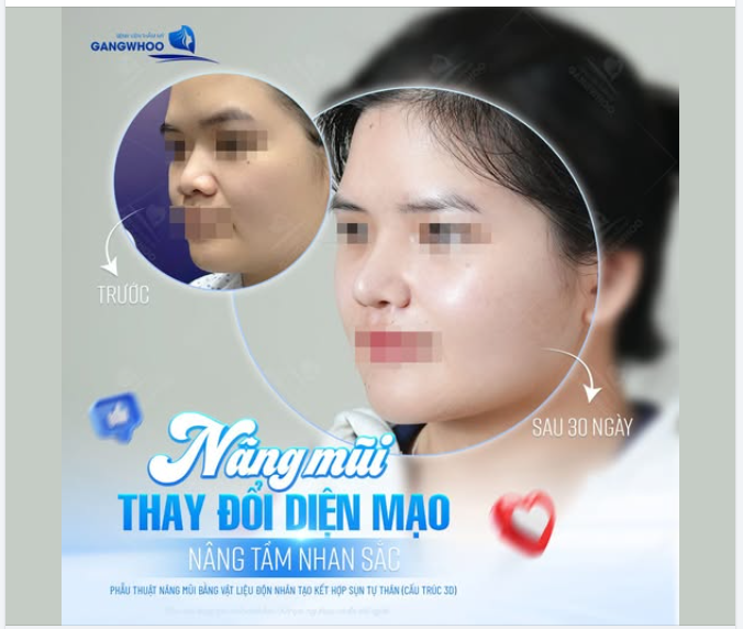 Hãy cùng chiêm ngưỡng màn "thăng hạng visual" ngoạn mục của khách hàng nhà Gangwhoo chỉ sau 30 ngày.