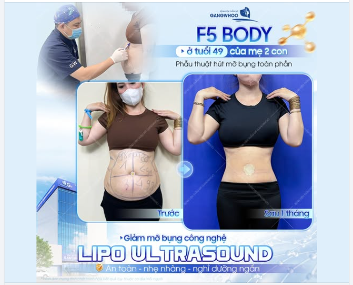 F5 VÓC DÁNG Ở TUỔI 49 – HÀNH TRÌNH CHĂM SÓC BẢN THÂN CỦA MẸ 2 CON