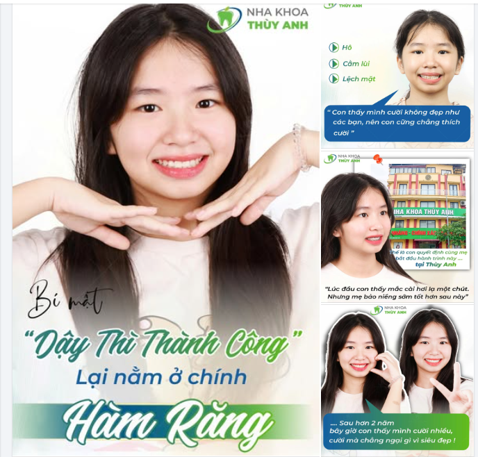 Ngày Bảo Ngân đến thăm khám, cô bé sinh năm 2012 mang theo một nụ cười khá… rụt rè.