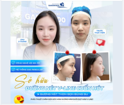 GƯƠNG MẶT THON GỌN ĐÚNG GU