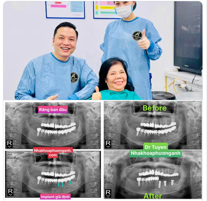 P/s: Đăng cái ảnh để thông báo với bà con biết bác sĩ vẫn còn làm chuyên môn.