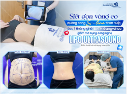 HÀI LÒNG VỚI VÒNG EO CỦA MÌNH