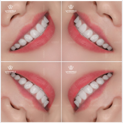 NỤ CƯỜI NGỌT NGÀO - BÔNG HOA Ý NGHĨA NHẤT CHO NGÀY CỦA PHÁI ĐẸP