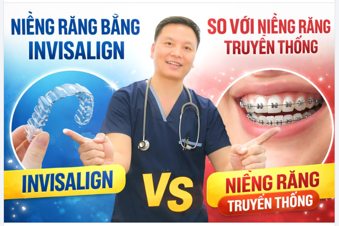 Niềng Răng Bằng Invisalign So Với Niềng Răng Truyền Thống