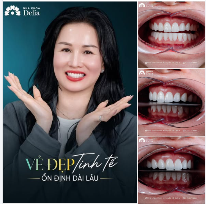 3 NĂM TRÔI QUA – NỤ CƯỜI DELIA VẪN NHƯ NGÀY ĐẦU