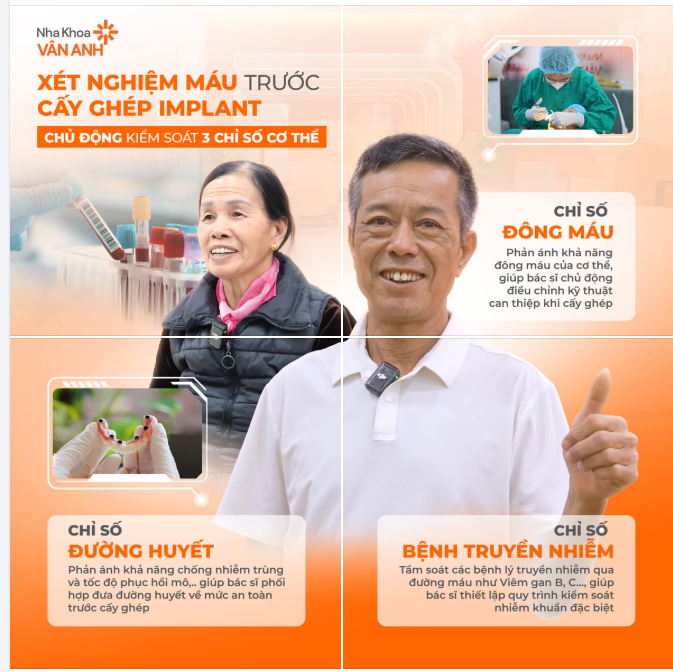 TĂNG TUỔI THỌ IMPLANT KHI CHỦ ĐỘNG KIỂM SOÁT 3 CHỈ SỐ DƯỚI ĐÂY TRƯỚC CẤY GHÉP